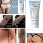 Cargar imagen en el visor de la galería, Armpit Whitening Cream
